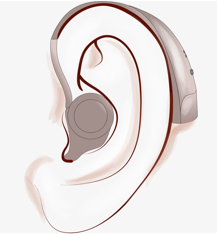 佩戴助聽(tīng)器的常見(jiàn)注意事項